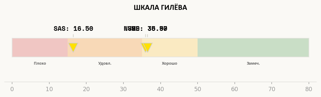 Шкала Гилёва с результатами E5-2680v4: NVMe и SSD в зоне «Хорошо», SAS в зоне «Удовлетворительно»